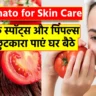 Tomato for Skin Care: डार्क स्पॉट्स और पिंपल्स से छुटकारा पाएं घर बैठे